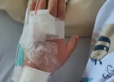 Šokējošs gadījums: māte domāja, ka dēlam ir smadzeņu audzējs, bet izrādījās, ka viņu saindēja ar D vitamīnu